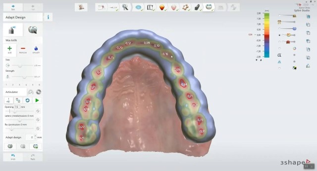 CADソフト 3shape社 Dental manager